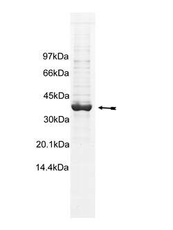 Eurofins DiscoverX EphB3 Protein, Active 10 &mu;g | Buy Online | Eurofins DiscoverX | Fisher Scientific